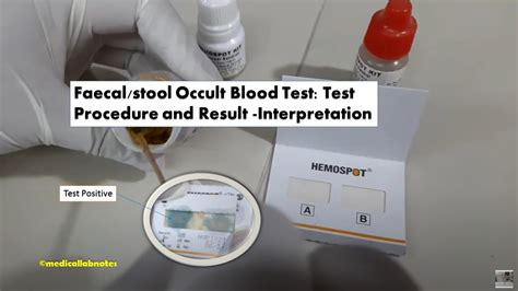 Positive occlut blood idc 10